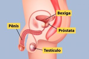 Prostatakrebs